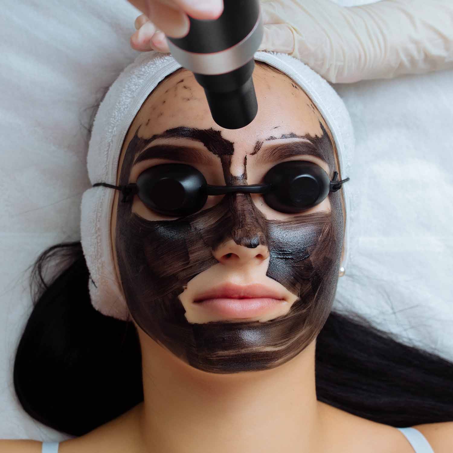 Carbon facial