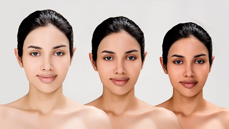 Skin whitening treatment